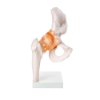 Hip Joint - Life Size Model