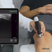Picture of Clarius L15 HD3 High-Frequency Linear Scanner
