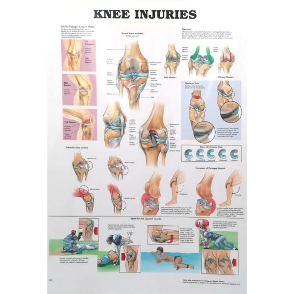 Knee Injuries